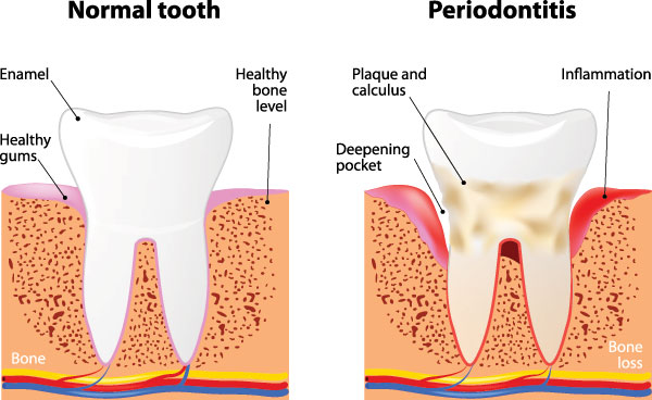 Dr. Wanda I. Salda  a | Dental Cleanings, Emergency Treatment and Perio Protect reg 